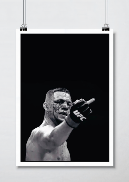 UFC